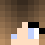Trying to be happy with acne.. :( - Female Minecraft Skins - image 3