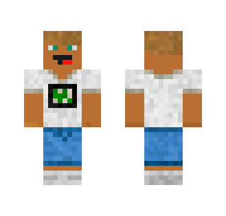 My little Brother's skin: Missstroo