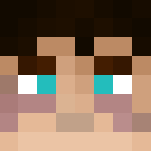 Hurt Prince Andor - Male Minecraft Skins - image 3
