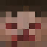 Injured Zombie - Male Minecraft Skins - image 3