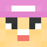Chubby cheeks. - Male Minecraft Skins - image 3