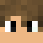 My skin - With a cast - Male Minecraft Skins - image 3