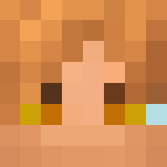 Injured Axros - Male Minecraft Skins - image 3